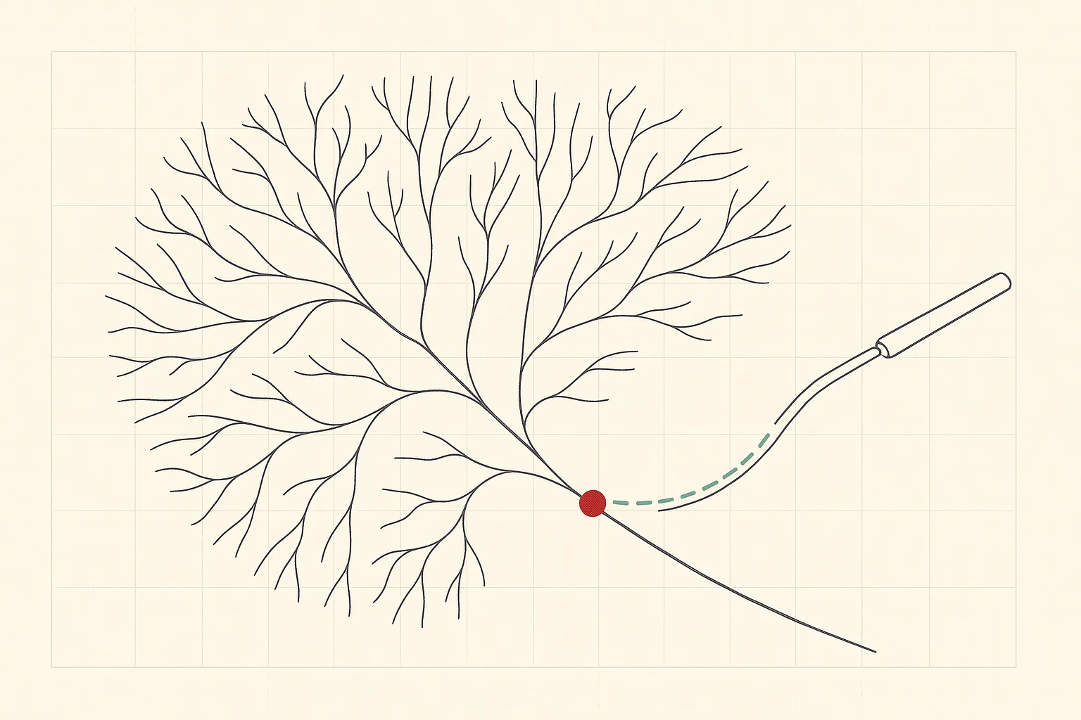 Technical line drawing of facial arteries as an abstract branching river delta in ink on paper, with a blunt cannula entering from the right along a dashed teal path and a single red dot marking the point where a vessel is blocked. No face is rendered and no text appears.